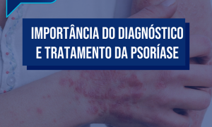 Importância do diagnóstico e tratamento da psoríase